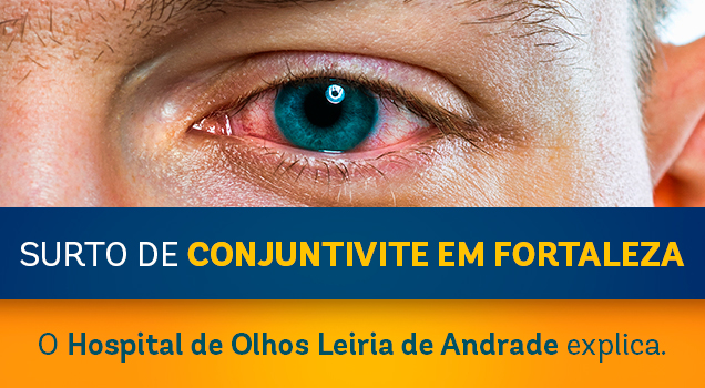 Surto de conjuntivite em Fortaleza – O Hospital de Olhos Leiria de Andrade explica
